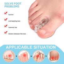 Kojų pirštų padalijimo korektorius Big Foot Bone Orthosis Clip kojos pirštas