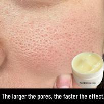 Herbal Repair Pore Minimizing Cream for Blackheads, Acne, and Wrinkles - Firming, Hydrating, and Cleansing Formula. 100g