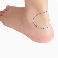 12pcs Thickened Transparent Invisible Gel Pads Anti-Wear Stickers Toe Heel Stickers Glue Body Grinding Forefoot Pads Waterproof Bubbles Watch shape