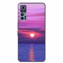 For TCL 30 Plus Case Luxury Soft Silicone Back Cover Phone Case for TCL 30 SE Coque TCL 30 5G for TCL 30+ Protector T676J Fundas TCL 30 SE
