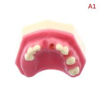 1pc Maxillary Sinus Teeth Model Dental Implant Student Teaching Practice Model Upper Jaw Sinus Lift Implants Restoration Model