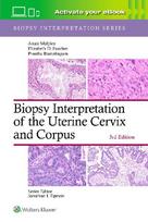 Biopsy Interpretation of the Uterine Cervix and Corpus: Print + eBook with Multimedia
