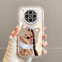 Premium Full Coverage Phone Case Vivo X300 Ultra X300s With Lanyard Mirror Finish Lightweight Luxury Design vivo X300s