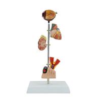 Diabetes Pathology Demonstration Human Organ Anatomy Model 1