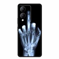 For vivo Y17s 4G Case Line Pattern Soft Silicone TPU Phone Cases for Vivo Y17S 4G Shockproof Funda Cool Animals Protective Cover For vivo Y17s 4G