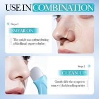 Stainless Steel Manual Blackhead Remover Scraper Gentle Acne Extractor Facial Beauty Tool for Daily Use dangaus mėlyna spalva