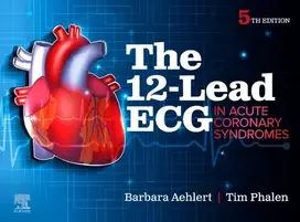 KNYGA Barbara J Aehlert 12-Lead ECG in Acute Coronary Syndromes