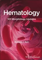 KNYGA Barbara J Bain Hematology