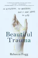 KNYGA Rebecca Fogg Beautiful Trauma