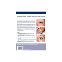 ILLUSTRATED GUIDE TO EYELID AND PERIORBITAL SURGERY APPLIED ANATOMY EXAMINATION BLEPHAROPLASTY (HB 2015) (Aesthetic Methods for Skin Rejuvenation Seri