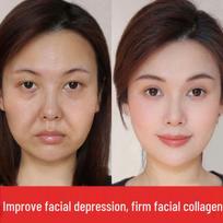 Collagen Face Cream: Tighten, Fill, Moisturize, and Reduce Wrinkles for a Smooth, Youthful Look 100g Jar
