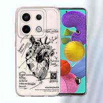 Case for Xiaomi Redmi Note 14 Pro Plus 12S 11S 12 14C 13C 11 10S 9 10 A4 Note 13 Soft Phone Cover Cartoon Heart Pattern Redmi Note 13 Pro+ 5G