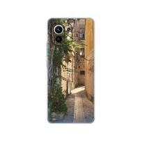 Skirta xiaomi Mi 11 | Mi 11 Lite 4G 5G NE| Mi 11i | Mi 11 Ultra Case Back xiaomi11 i 11Lite Telefono dangtelis Xiomi Mi11Lite Silicon TPU For Xiaomi Mi 11 black