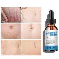 Randų šalinimo drėkinamasis kremas 1 vnt. Priešuždegiminis atstatomasis kūno kremas 5ml beige