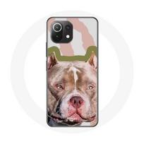 Coque pour Xiaomi Mi 11 Lite Chien de Pitbull marron ruda