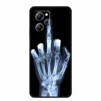 For Xiaomi Poco X5 Pro Case Animals Soft Silicone TPU Phone Cases Back Cover for Poco X5 5G Fashion Protective Shockproof Fundas For Poco X5 Pro gray