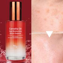 ANJO Luxury Red Camellia Serum Essence – Dark Spot Reduction and Pore Refining red