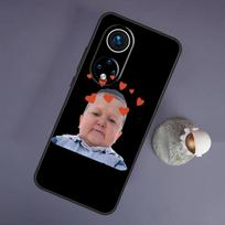Funny Hasbulla For Huawei Honor Magic 5 Lite 70 50 X8 X9 a P20 P30 P40 P50 P60 Pro P Smart Nova 9 5T Case Honor X9a black