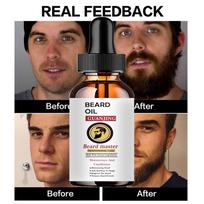 Beard Growth Oil Spray Greito plaukų augimo eterinių aliejų esencijos serumas tirštesnės pilnesnės barzdos drėkinamasis plaukų augimo aliejus 5ml