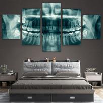 Sienų meno paveikslai Namų dekoras Modernūs HD spaudiniai Drobė 5 paneliai Dantų rentgenas Stomatologas Paveikslas Sveikata Medicina Plakatas 20x35cm*2  20x45cm*2  20x55cm*1