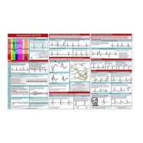 EKG kišeninis vadovas EKG ritmo interpretacija Dvipusė kišeninė informacinė kortelė Trinarė studijų knygelė studentams, slaugytojams 1pc