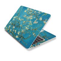 „Pasidaryk pats“ nešiojamųjų kompiuterių lipdukų apvalkalai, skirti „Macbook“ / HP / „Dell“ / „Lenovo“ / „Acer“ / „ASUS Universal“ 3