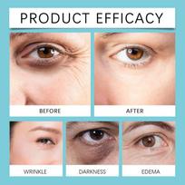 Hoygi Eye Firming Cream Fade Fine Lines Lightening Dark Circles Anti-Aging Hydrating Reduce Wrinkles Lifting Eyes Cream 1pcs
