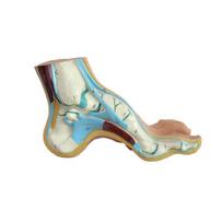 Human Foot Model Foot Muscles Flatfoot Talipes Cavus Bow Foot Model Anatomical Anatomy Medical Science Teaching Model Freeship