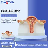 Female Reproductive System Model: Uterus, Vagina, Ovary Teaching Aid 11*11*10 cm beige