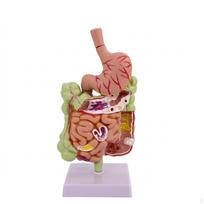 Large Intestine Model with Stomach Pathology Digestive System Colon