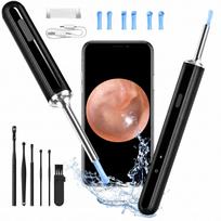 Otoskopas Qimic X8 su WiFi, 1080P kamera ir USB-C, LED ausų valymui