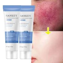 Veido raudonį mažinantis kremas Jautriai odai raminti Sausumui drėkiklis Drėkinantis losjonas Raudonį šalinantis Rosacea Korėjietiška kosmetika mažiau