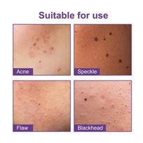 Cartoon  Pimple Patches 216PCS Hydrocolloid Invisible Spot Stickers Makeup Tools for Face Skin Care at Home one size