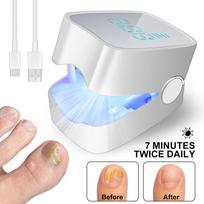 Išmani nagų grybelio lempa UV sterilizacija Manikiūro įrankis Mini automatinis lazerinis prietaisas Fungus cleaning light