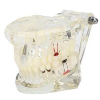 Transparent Disease Teeth Model laboratory Pathological Anatomy Study Teaching Tooth Model white