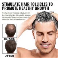 3pcs Spartan Root Activator Shampoo, Spartan Hair Loss Shampoo,shampoo Root Activator-TF less