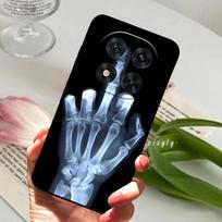 For Poco X7 Case X7 Pro 5G TPU Soft Silicone Phone Cover For Xiaomi Redmi Note 14 Pro Coque Turbo 4 Shockproof Bumper Fundas -Redmi Turbo4(China)