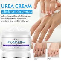 Moika 40% Urea 2% Salicylic Acid Foot Cream Hand Care Moisturizing Cream Anti Cracking Remove Dead Skin Care 100g beige