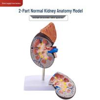 Magnified Human Kidney Model with Adrenal Gland and Diseased Anatomy brown