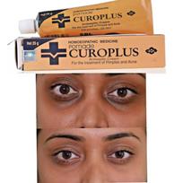 SBL Curoplus Ointment (25g) For Acne, Pimples, Skin Darkening, Dark Circles