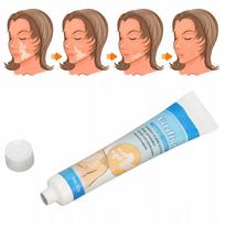 Odos pigmentacijos tepalo Vitiligo, 20 g