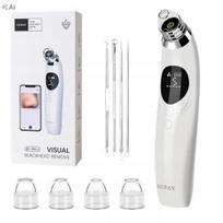Veido porų valymo siurblys GUPAY su 1080P HD kamera, 5 režimai, 4 antgaliai, USB-C