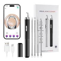 Visualable Electric Blackhead Remover Pimple Extractor Kit - Acne & Pore Cleaner Deep Cleaning Tool Set for Facial Skin Care juoda