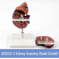 Magnified Human Kidney & Adrenal Gland Model with Diseased Kidney Anatomy brown