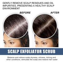 Moisturizing Scalp Scrub for Dry Scalp Deep Cleansing and Exfoliating Cream for Itchy Head and Daily Hair Care one size gray