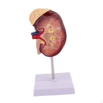Human Kidney Model with Adrenal Gland Teaching Tool Internal Organ for Classroom Accessory brown