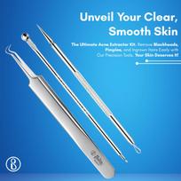 Beauté Secrets Acne Extractor Kit, Blackhead Tweezers and Needle, Pimple Remover tools, Ingrown Hairs And Facial Impurities Removal Set