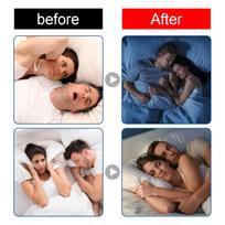 Sleep Strips Mouth Tape for Less Mouth Breathing Better Sleeping Instant Snoring Relief Snoring Solution Sleep Aid Strips gray