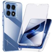 Visas Korpusas - Xiaomi - 14T Pro - Pilna Apsauga - Skaidrus - Patobulintas Laikymas