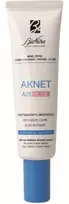 BioNike Aknet Ramus ir raminantis dienos ir nakties kremas veidui, 30 ml
